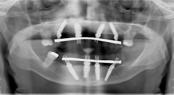 Imagen ilustrativa de la propuesta dental